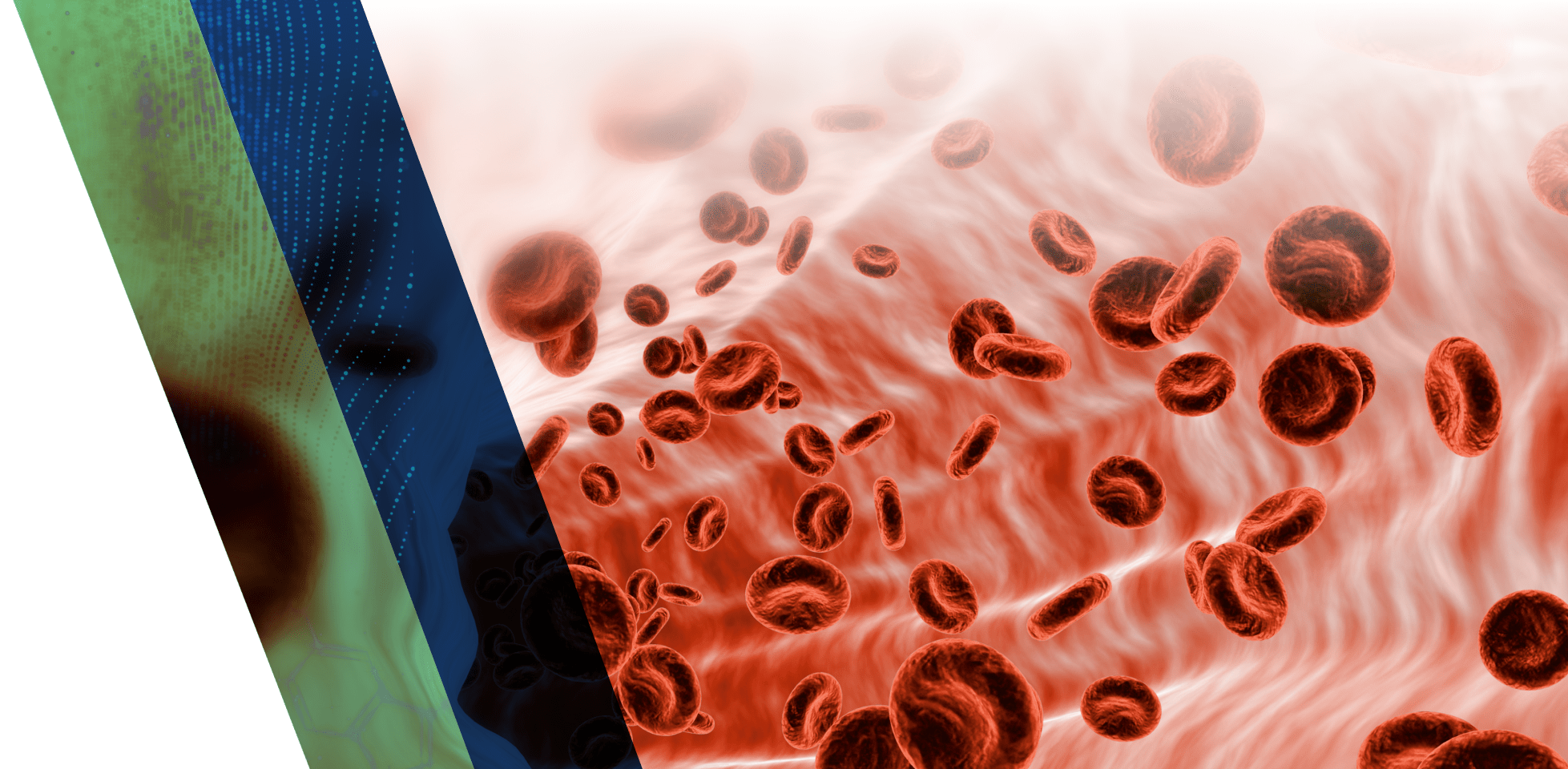 Red blood cells travel through an artery.
