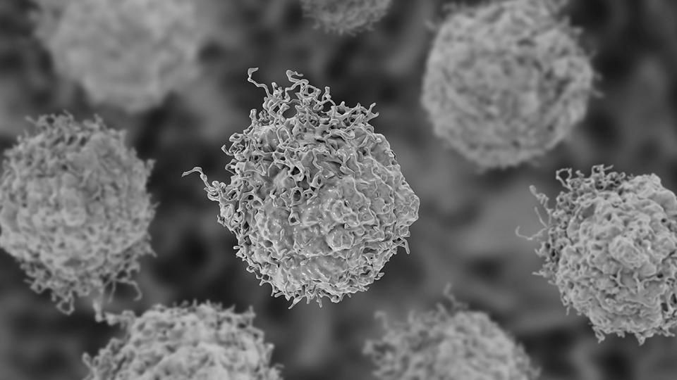 Minimal Residual Disease (MRD)